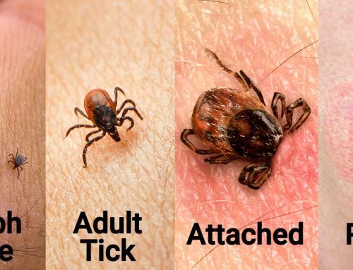 Lyme Disease –  Basic Information