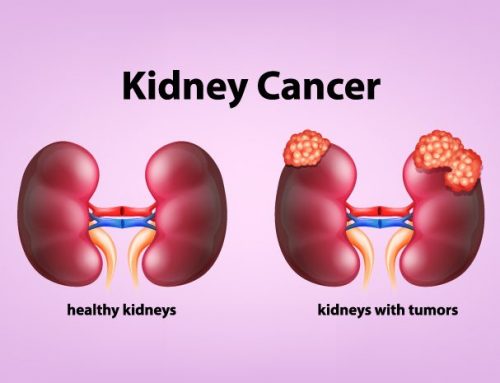 Kidney Cancer = Types of Treatment