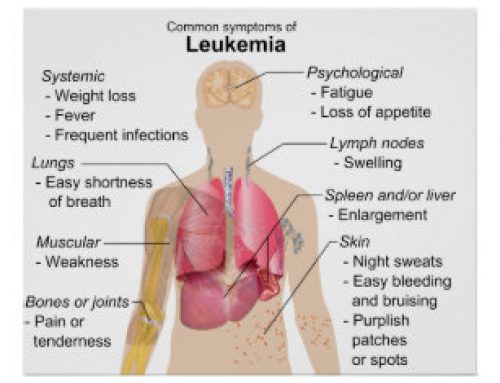 Leukemia Information – The Basics